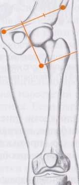 Блокада седалищного нерва передним доступом Блокада седалищного нерва передним доступом